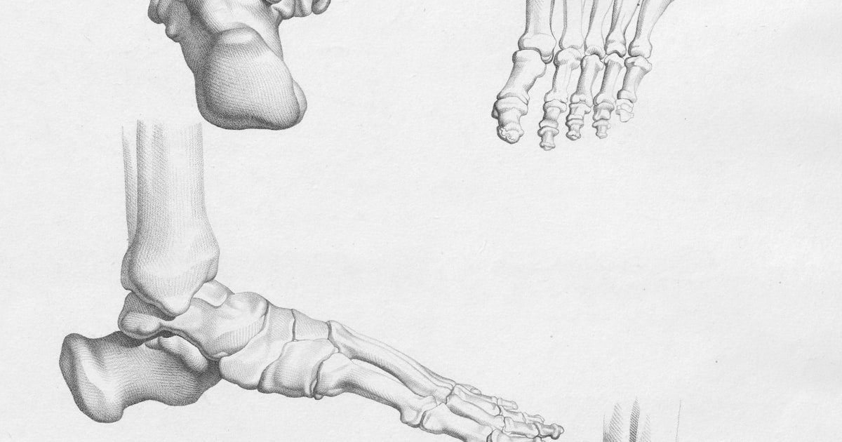 Plantillas ortopédicas 3D para dolor metatarsal
