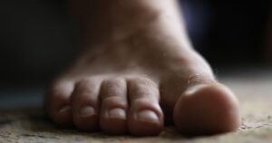 Plantillas ortopédicas 3D para fascitis plantar