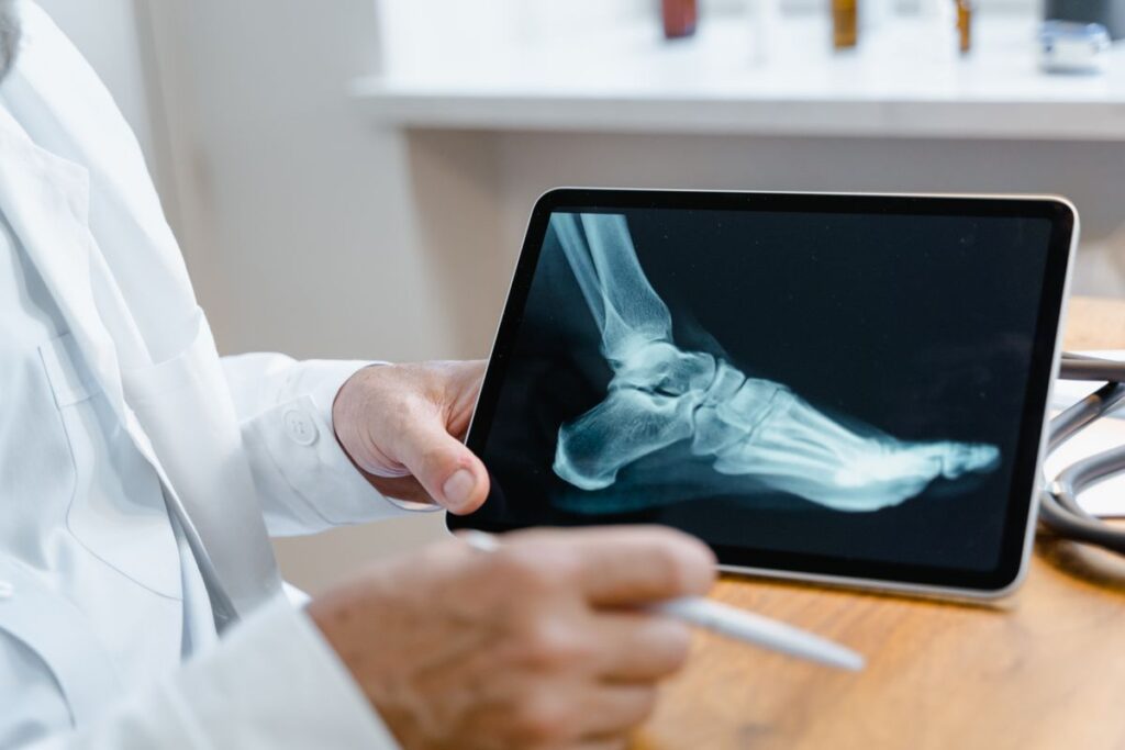 Profesional de salud revisando una radiografía del pie en una tablet