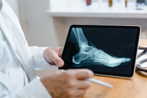 Profesional de salud revisando una radiografía del pie en una tablet