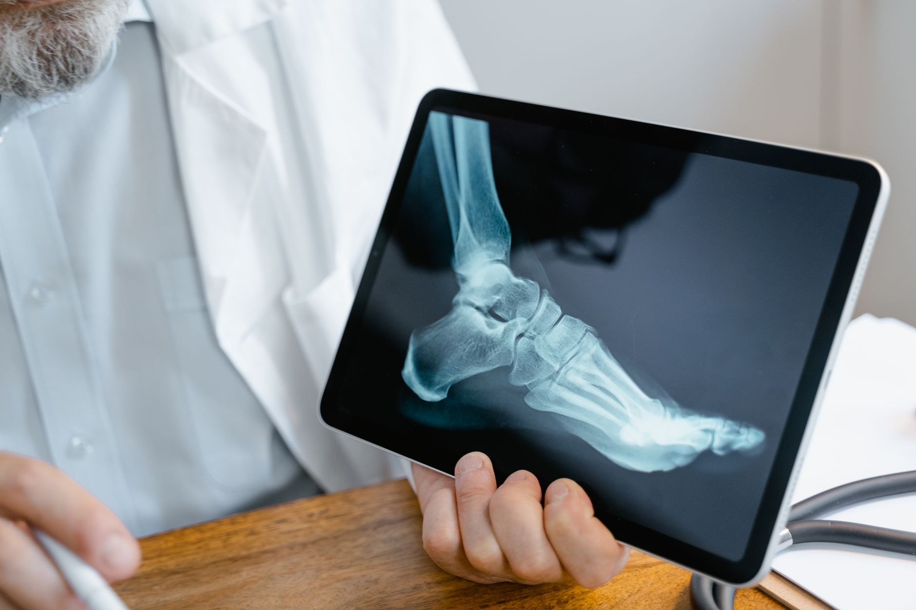 person holding an x ray result of a foot